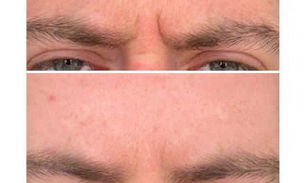 20 Units of Letybo - Youthful Glow