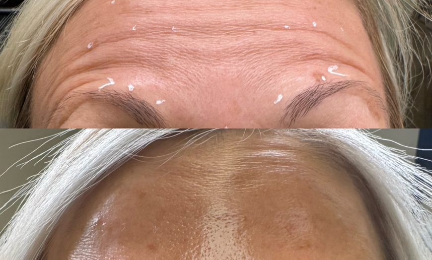 Image 2: Get a Youthful Glow with 20, 40, or 60 Units of Daxxify