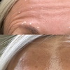 Image 2: Get a Youthful Glow with 20, 40, or 60 Units of Daxxify