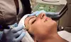 One or Three Microdermabrasion Treatments or Chemical Peels at Zen Afterglow (Up to 58% Off)