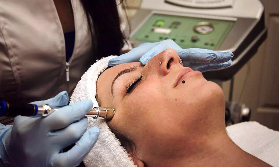One or Three Microdermabrasion Treatments or Chemical Peels at Zen Afterglow (Up to 58% Off) - Primary Image