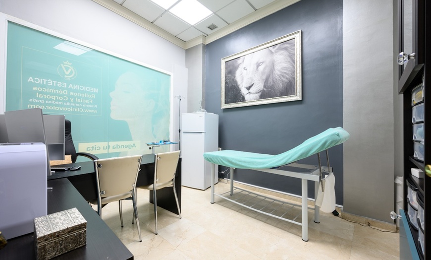 Image 14: ¡Hilos tensores monofilamento con opción a mesoterapia!