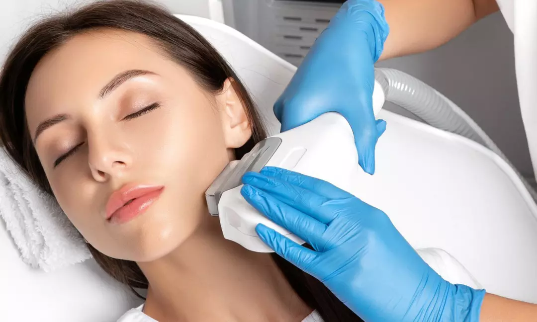 1 o 3 sesiones de láser IPL facial para eliminación de manchas para 1