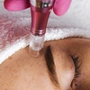 Image 1: Get One, or Three PRP Facials, Vampire Face Tightening & Microneedling