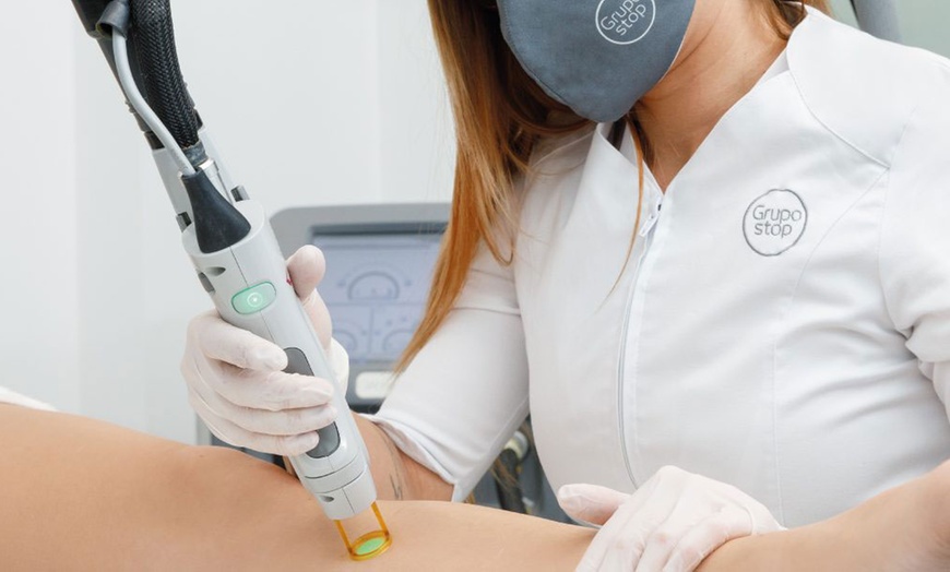 Image 1: Depilación láser DúoTechnology® para mujer y hombre en zonas clave
