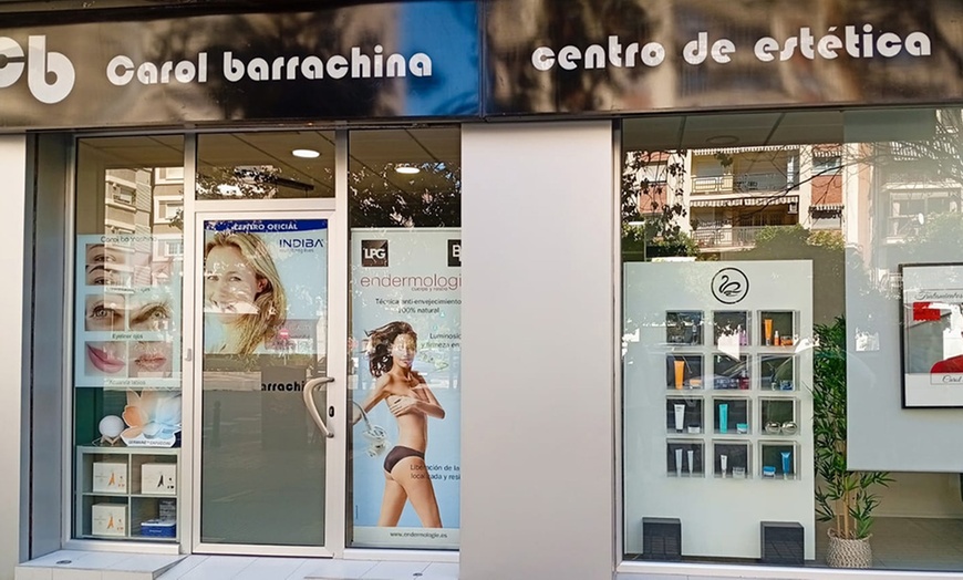 Image 9: Rejuvenecimiento facial con láser y velo de colágeno luminoso