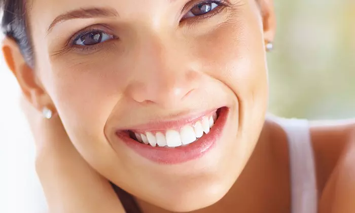 Limpieza+fluorización