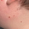 Image 3: 3 Laser Tattoo Removal Sessions: Small, Medium, Large or XL Areas