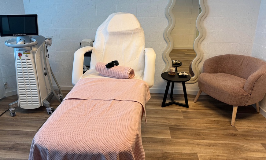 Image 3: Laserontharen voor zone naar keuze met tot 67% korting 