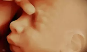 Ecografía 5D con opción a revelación especial del sexo del bebé con foto impresa, con hasta un 33% de descuento