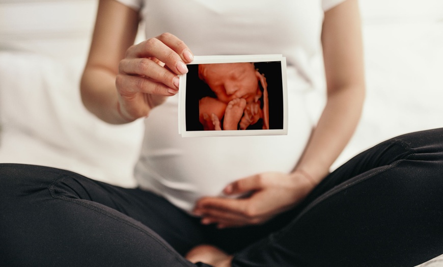 Image 1: Ecografía 4D/5D con foto y opción a revelación de género y vídeo