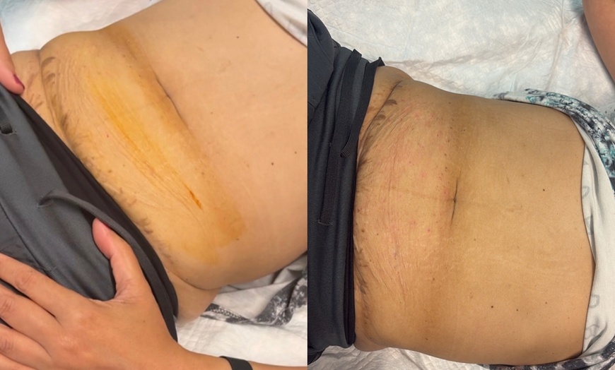 Image 2:  Unwind with a One or Two Lymphatic Massages