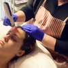 Image 1: One, Two, Three or Four Sessions of Full Face Micro-Needling