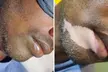 Transform Your Skin with Vitiligo or Stretch Marks Camouflage Services (Up to 30% Off) at Tattoos By The Bay - Second Medium