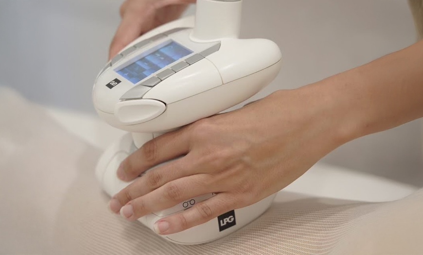 Image 3: Transform with One, Two, or Six  LPG Endermologie Session