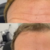 Image 3: Revitalize with 20, 40, or 60 units Units of Jeuveau