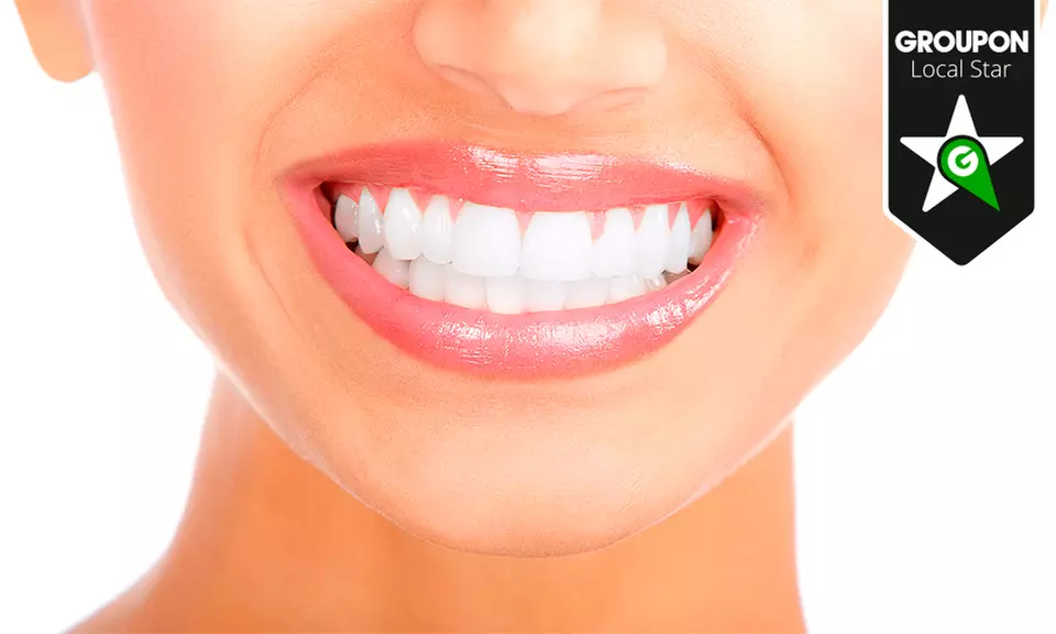 Limpieza bucal por 12,90 € y con 1 o 2 sesiones de blanqueamiento desde 59,90 € - Primary Image