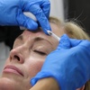 Image 2: 20 Units of Botox at Total Med Solutions