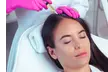Up to 57% Off on Vampire Facelift at Aesthetics Medical Clinic - Second Medium