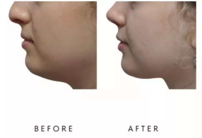 Up to 46% Off on Electrical Muscle Stimulation at Your Sculpt Studio