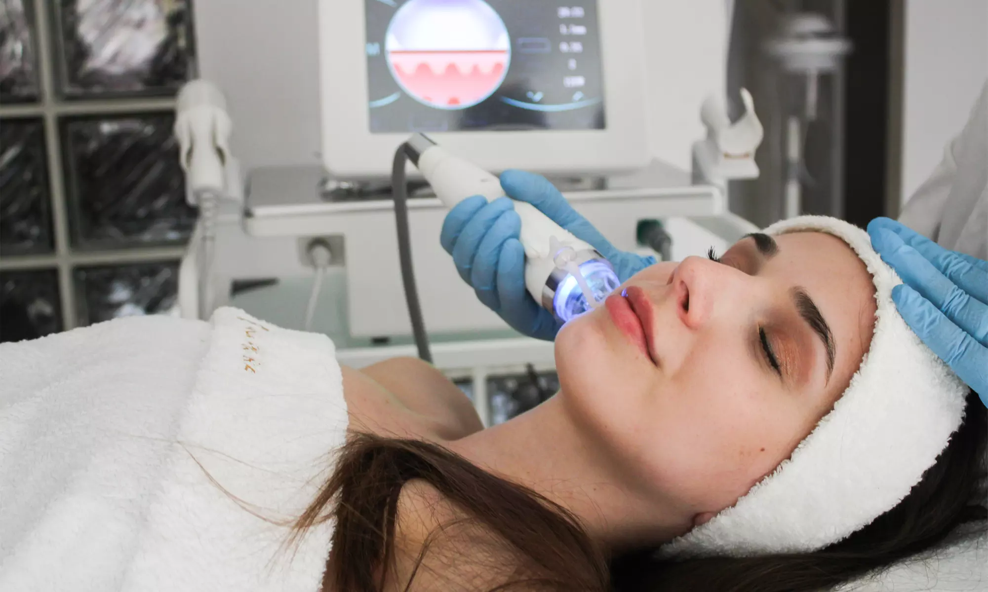 Lifting i redukcja zmarszczek: RF frakcyjny mikroigłowy