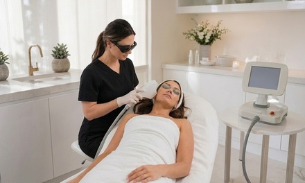 One Chemical Peel Full Face - Perfection Cosmetic Clinic