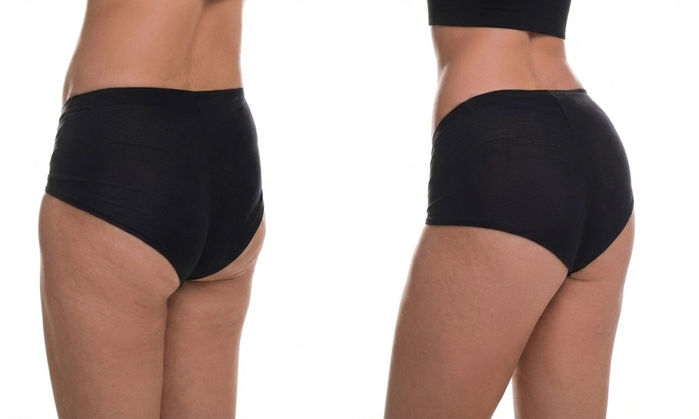 Butt Boost: 60-Minute Sculpting with Seaweed & Advanced Therapies