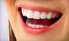 $149 for Zoom! Teeth-Whitening Treatment at North Kansas City Dental Group ($495 Value)