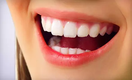 $149 for Zoom! Teeth-Whitening Treatment at North Kansas City Dental Group ($495 Value) - Primary Image