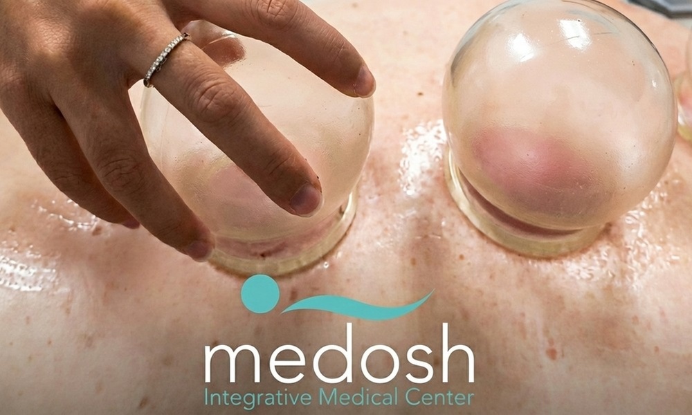 Revive Your Body with 60-Minute Cupping/Hijama Session