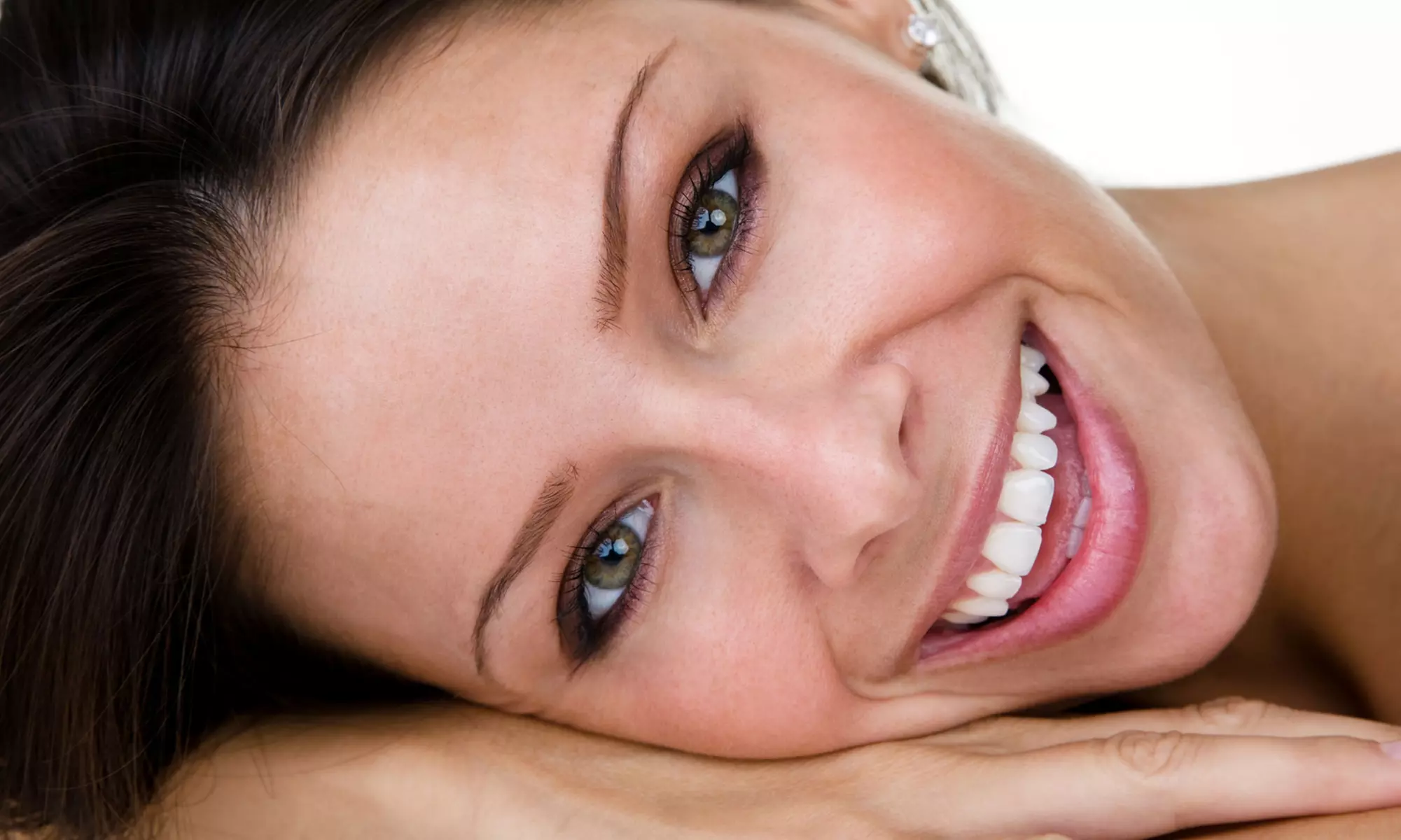 Two, Four, or Six Porcelain Dental Veneers with Exam and X-rays from Stephen Conrad, DDS (Up to 57% Off) - Primary Image