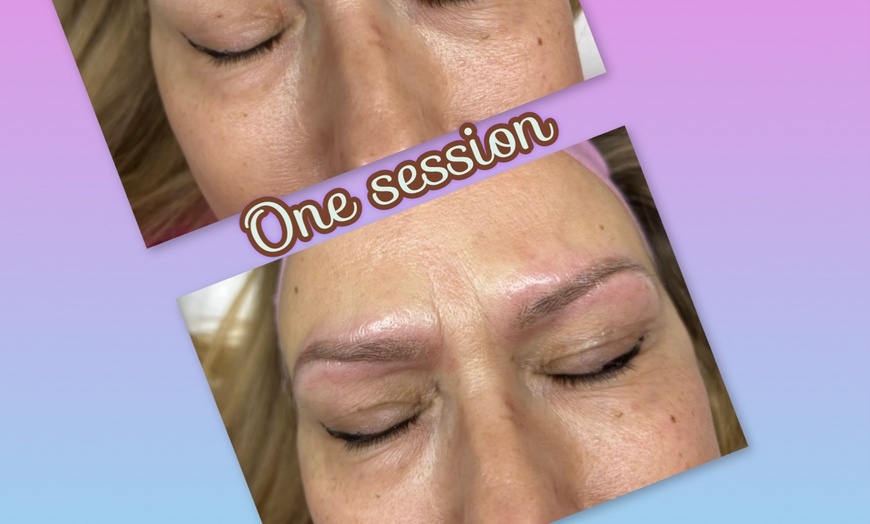 Image 4: Eyebrow Tattoo Removal: Save Up to 30% Off at MB Advanced Beauty MED!