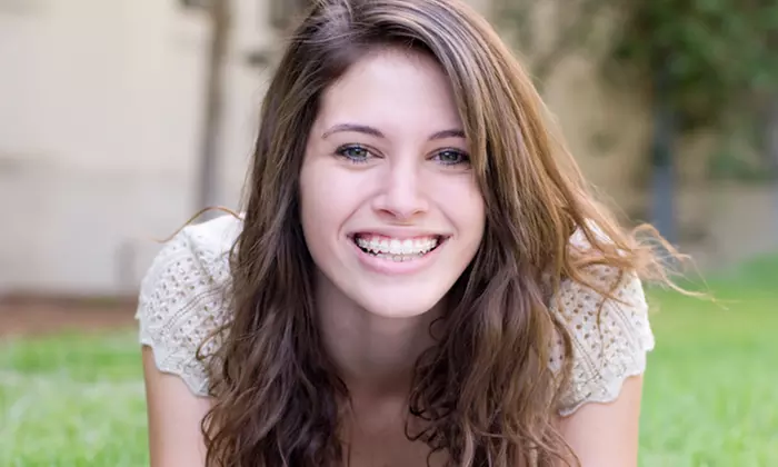 $29.50 for a Fast Braces Miami Orthodontic Package at Feel Good Dentistry ($660 Value)    - Primary Image