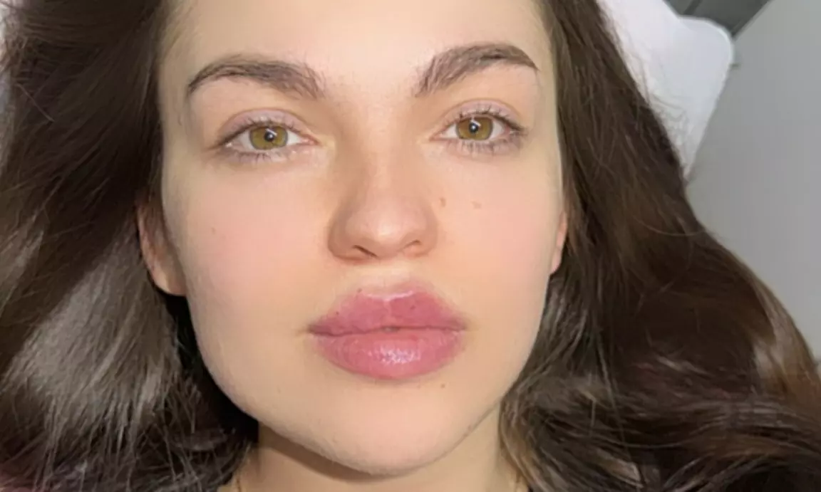 0.5ml or 1ml Dermal Filler, Skin Booster or Mesotherapy