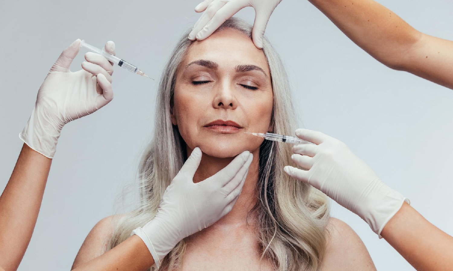 Transform Your Smile w/ 1 Restylane Kysse Syringe for Lip Augmentation