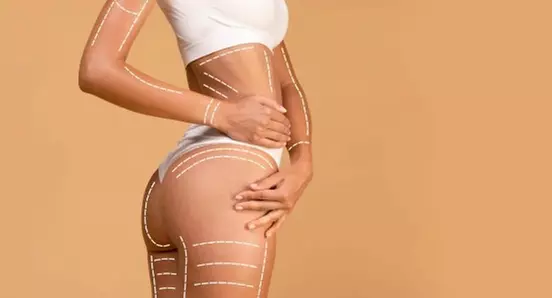 Einzel- oder 3er-Sitzung à 30 Min. Po-Lift durch Vakuum-Anwendung