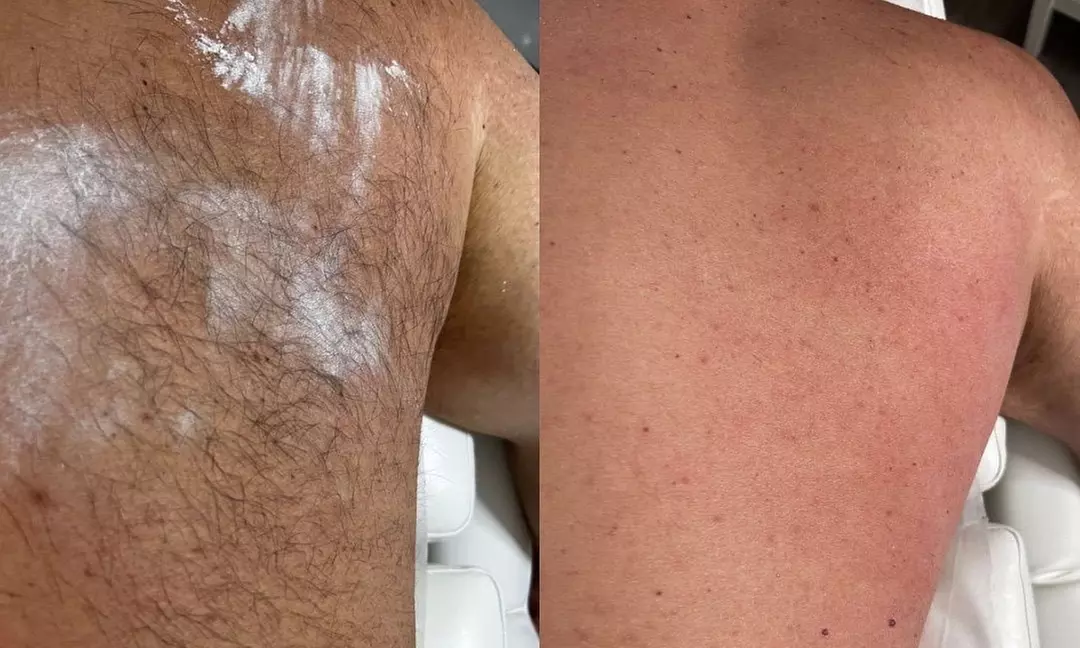 Women Brazilian Wax / Brazilian + Underarm / All-Gender Full Back Wax