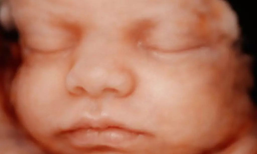 Tu bebé más cerca: ecografía 4D-5D emocional básica o plus