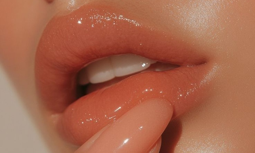 Image 2: 0.5 ML, 1 ML or 2 ML For Lip or Chin or Cheek with Consultation