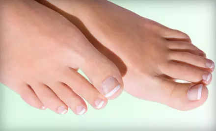 $249 for a Laser Nail-Fungus Treatment for One Foot at Laser Nail Therapy Clinic ($750 Value) - Primary Image
