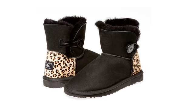 zebra print ugg boots