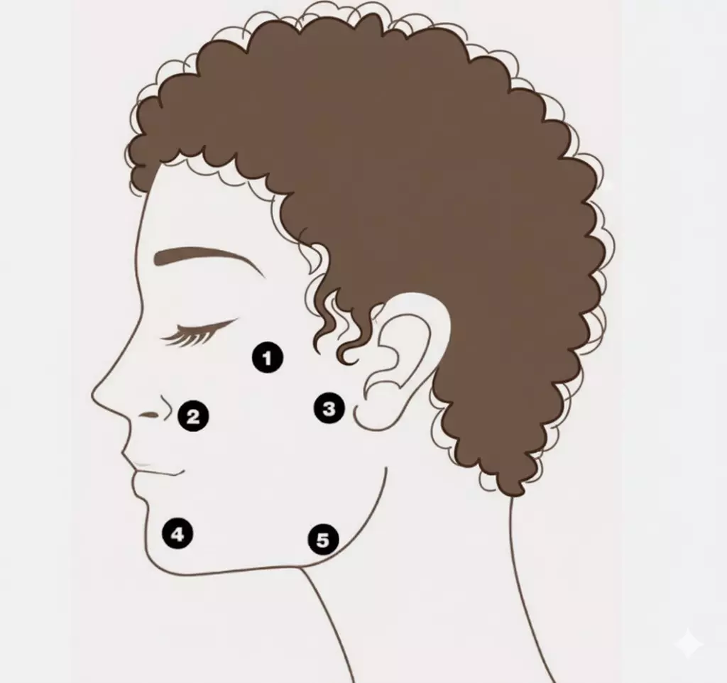 10- oder 16 Punkte Hyaluron-Lifting mit innovativer BAP-Technik