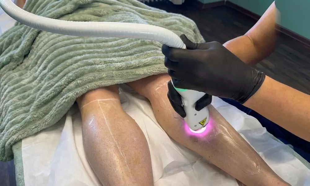 Dioden-Laser-Haarentfernungen auf Achsel – 1 oder 2 Behandlungen