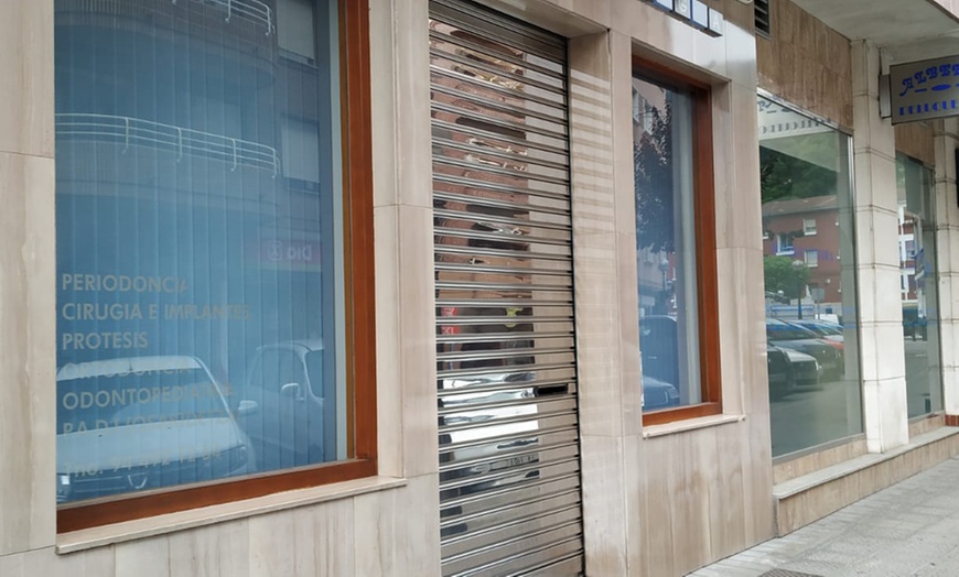 Image 5: Carillas dentales de composite con diseño digital de sonrisa