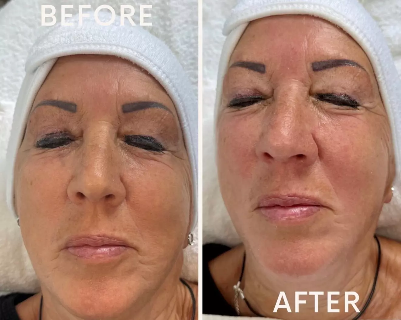 Hydrafacial Glow & Lashlifting bij Beauty Clinic by Nouha