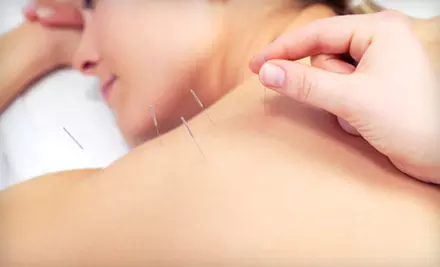 Two or Four Acupuncture Sessions at Vitality Acupuncture & Integrative Medicine (74% Off) - Primary Image