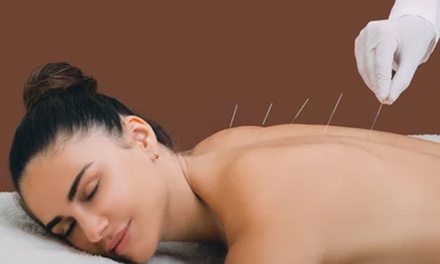 One 40-Minute Acupuncture Session