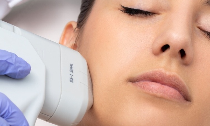 Image 4: HIFU Skin Tightening & Anti-Ageing Treatment at Diamond Beauty Clinic