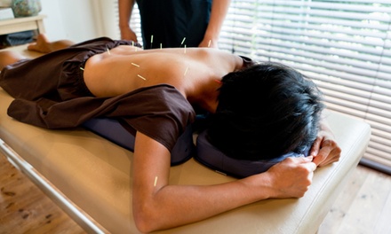 45-Minute Acupuncture Treatment with Consultation Included - MA Health and Wellbeing Centre