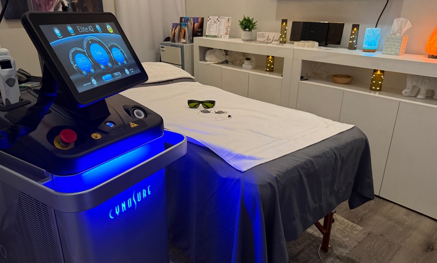 Image 4: Spider Vein Removal for a 2x2 / 4x4 Area Or Full Leg Treatment